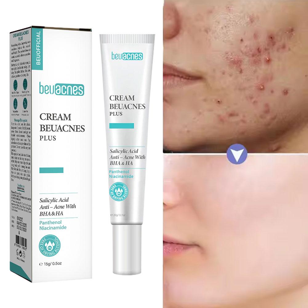 New 20g Niacinamide Acne Gel A - Skincare Niacinamide reseña y precio