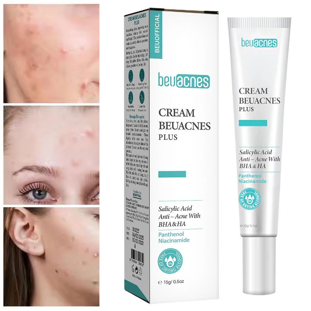 New 20g Niacinamide Acne Gel A - Skincare Niacinamide reseña y precio