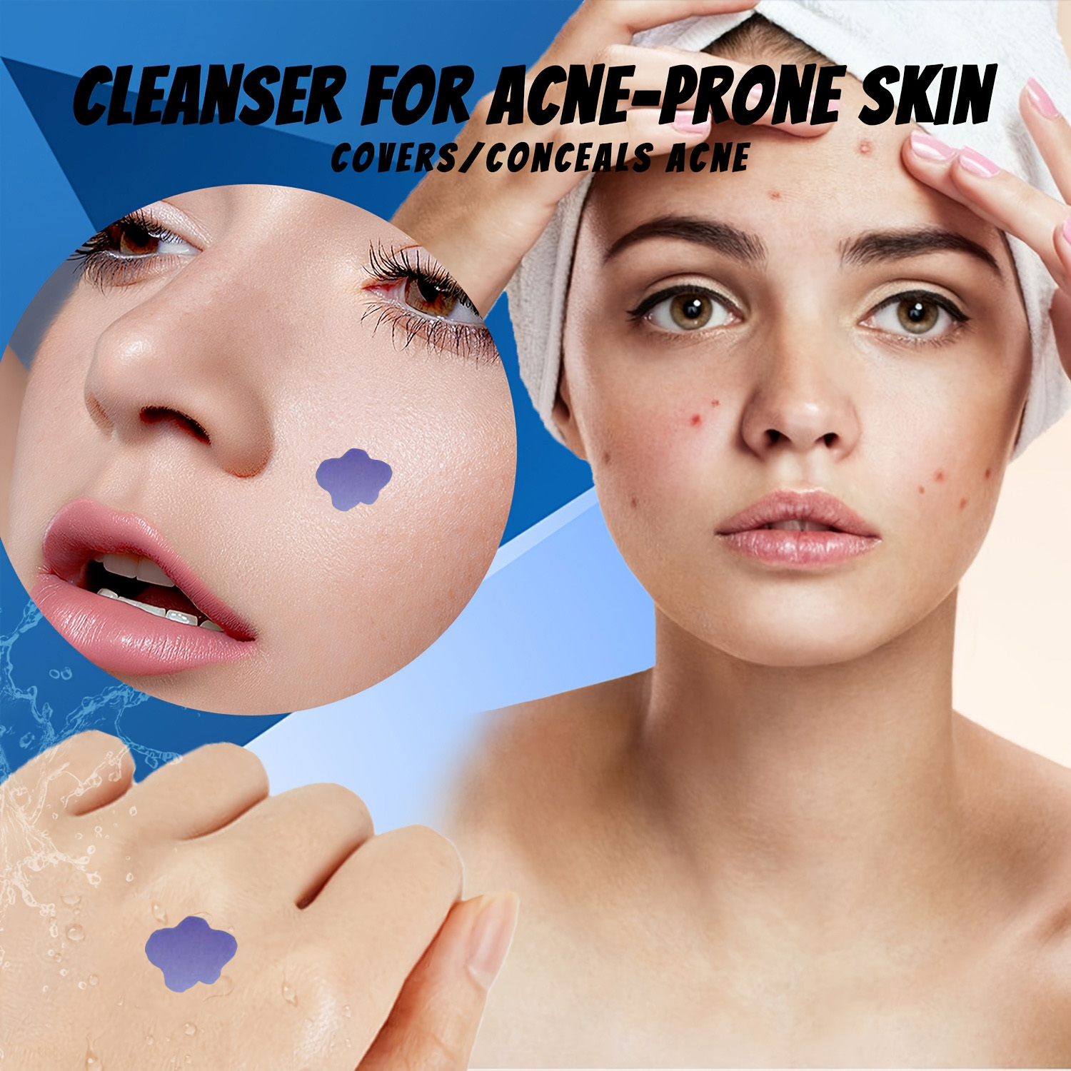 Microneedle Acne Pimple Patch  - Skincare You reseña y precio