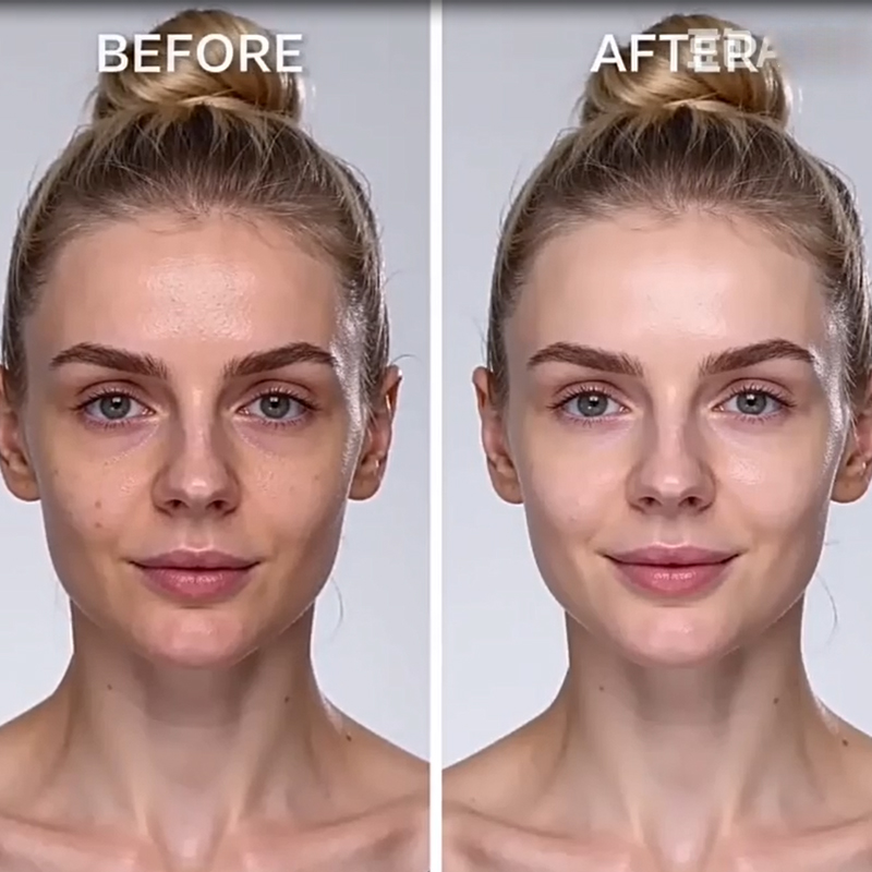 Salmon DNA Sodium Anti-wrinkle - Coenzyme Q10 Cream reseña y precio