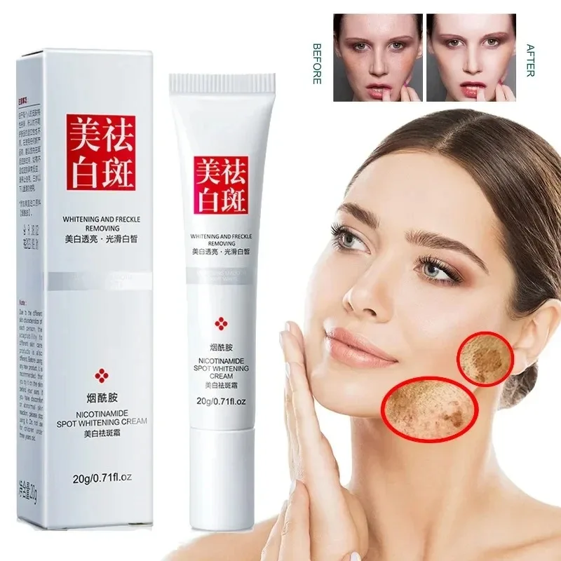 Fades Freckle Dark Spots Face  - Skincare Niacinamide reseña y precio