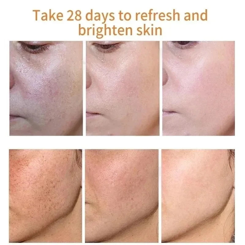 Fades Freckle Dark Spots Face  - Skincare Niacinamide reseña y precio