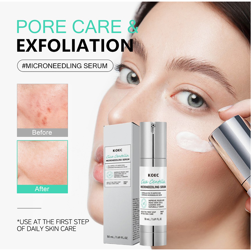 Soothing Microneedle Serum, Ce - Centella Asiatica Toner reseña y precio