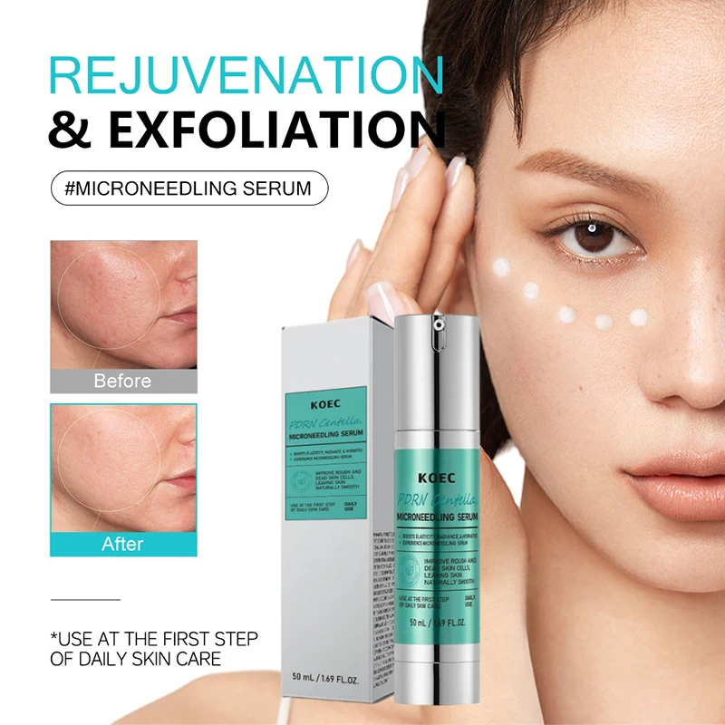 Soothing Microneedle Serum, Ce - Centella Asiatica Toner reseña y precio