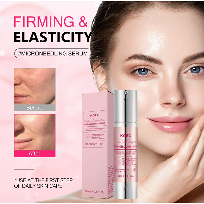 Soothing Microneedle Serum, Ce - Centella Asiatica Toner reseña y precio
