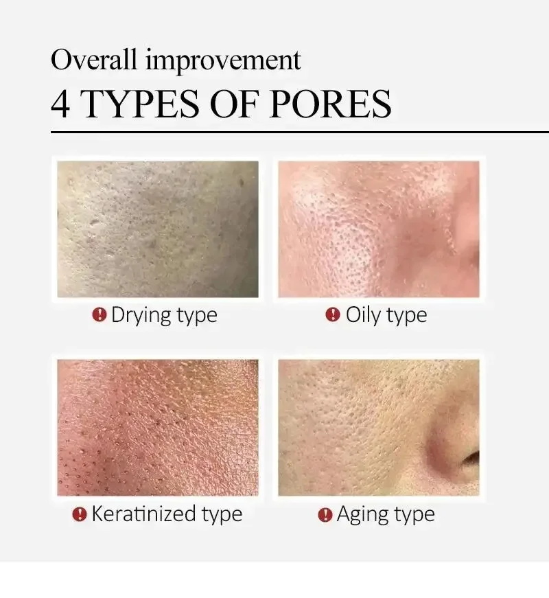 Centella Asiatica Shrink Pores - Skincare Centella reseña y precio